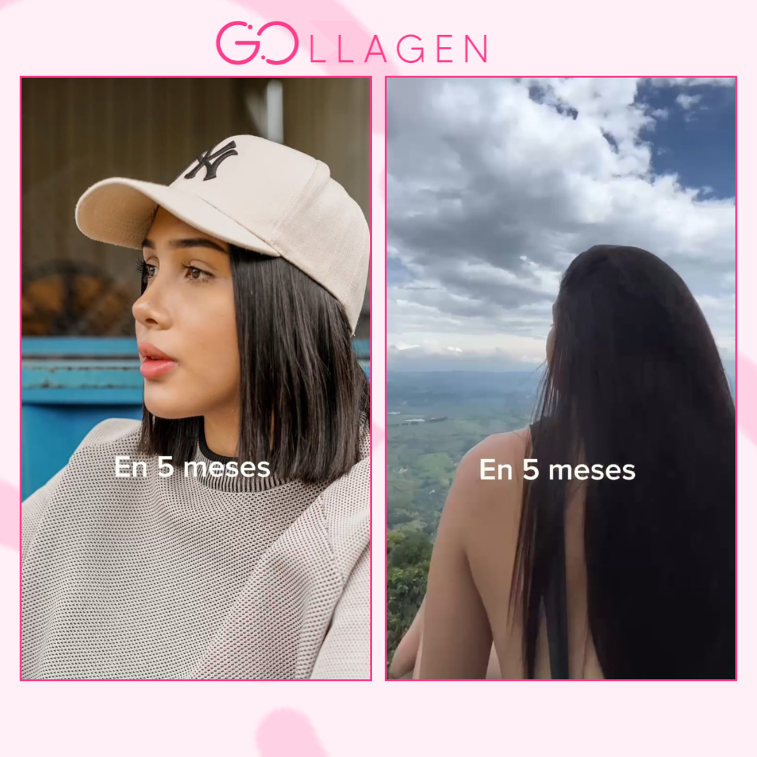 Gollagen- Colageno hidrolizado